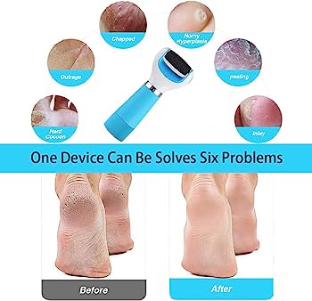 Callous remover
